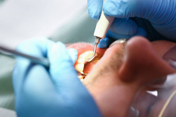 Best Emergency Care for Gum Disease in Laurel Hill, VA