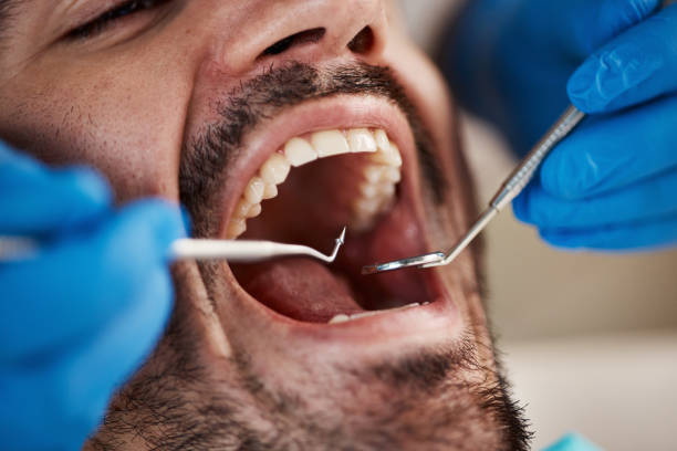 Best Emergency Care for Gum Disease in Laurel Hill, VA